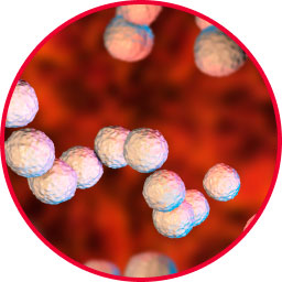 Streptococcus pyogenes